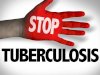 Stop Diskriminasi, Temukan dan Obati Penderita Tuberkulosis Sampai Sembuh