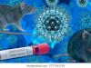 Diagnosis dan Tatalaksana Penyakit Virus Hanta